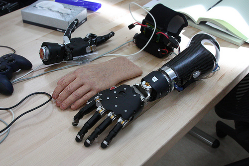 Myoelectric hand